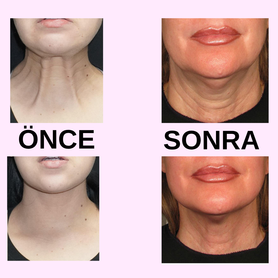 Amoria Gold Hals-Kollagenmaske